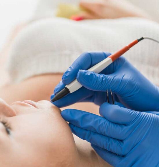 Ριζική με βελόνα